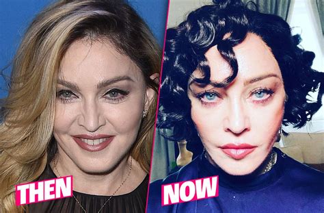 madonna plastic surgery photos